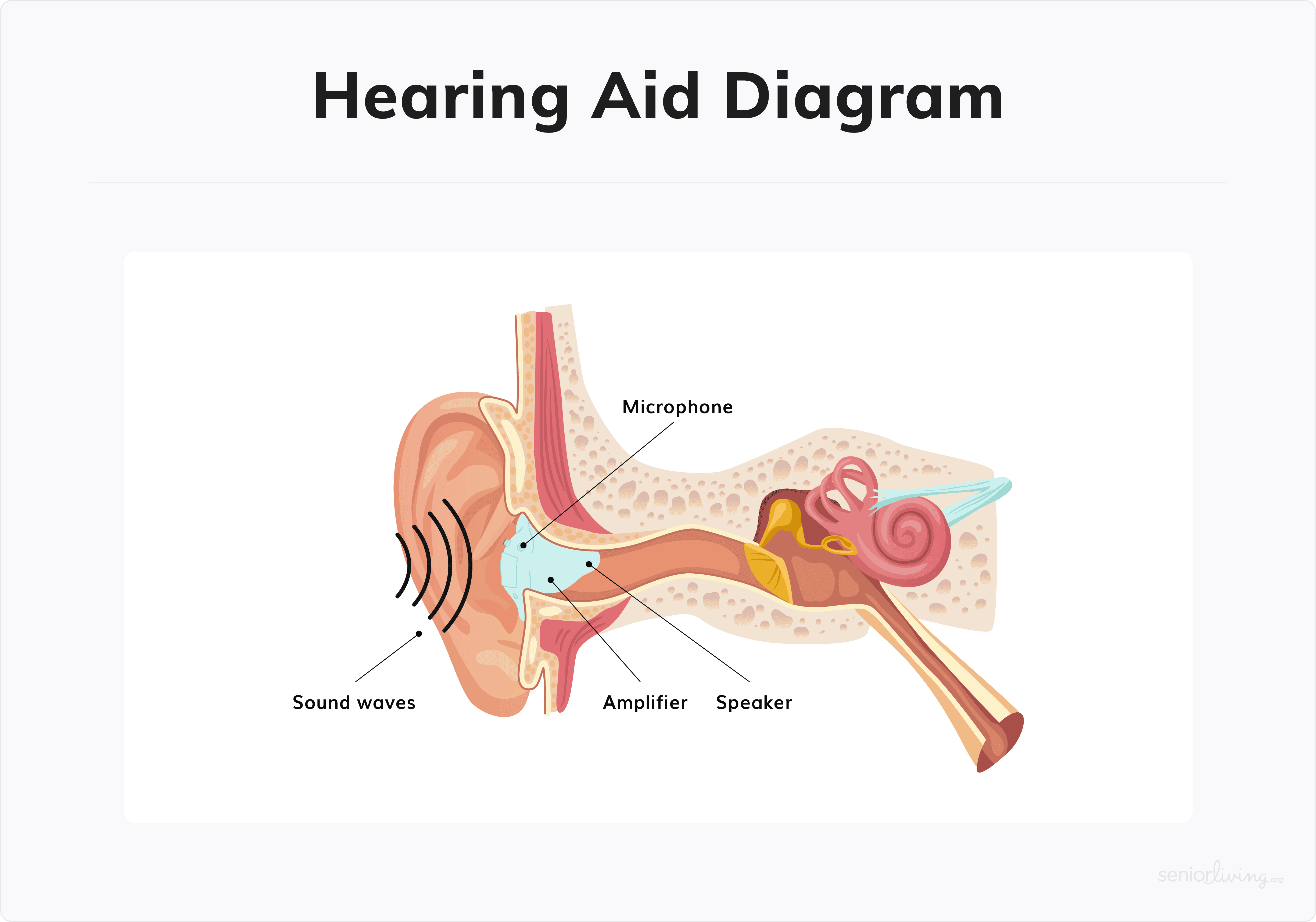 Hearing Aid Diagram